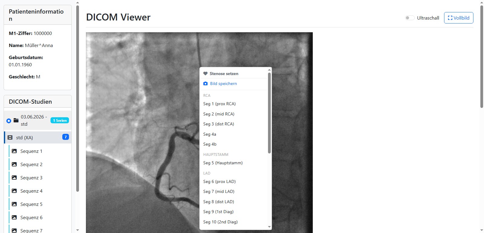 DICOM-Viewer mit Koronarangiografie und Rechtsklick-Befundung