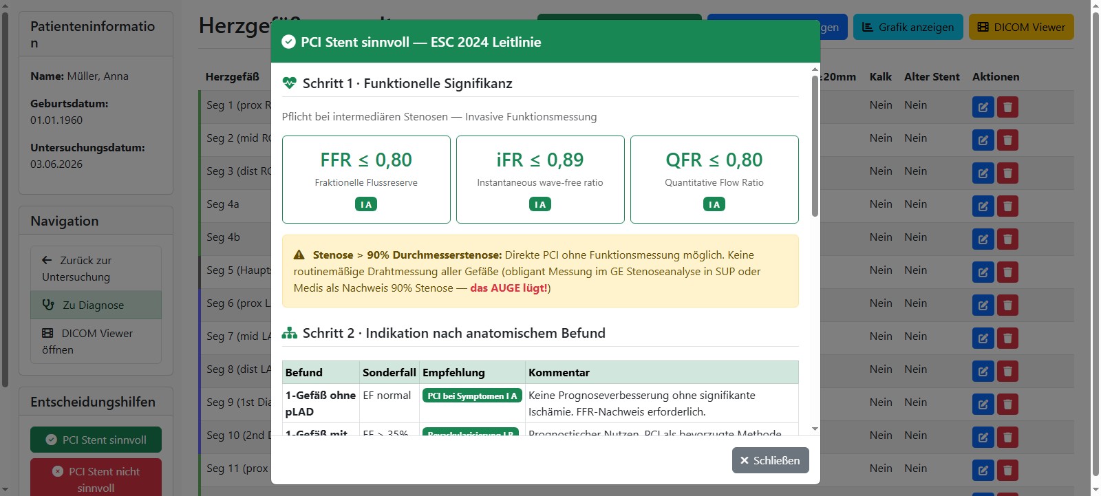 Leitlinien-Entscheidungshilfe PCI nach ESC 2024